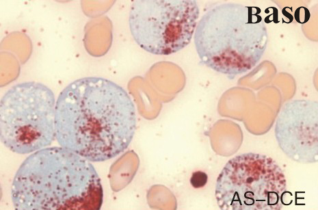 �ȴ���AS-D������øȾҺ(AS-DCE)