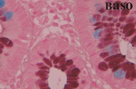 ���F����-��(��i)���{(l��n)(HID-AB)ȾɫҺ